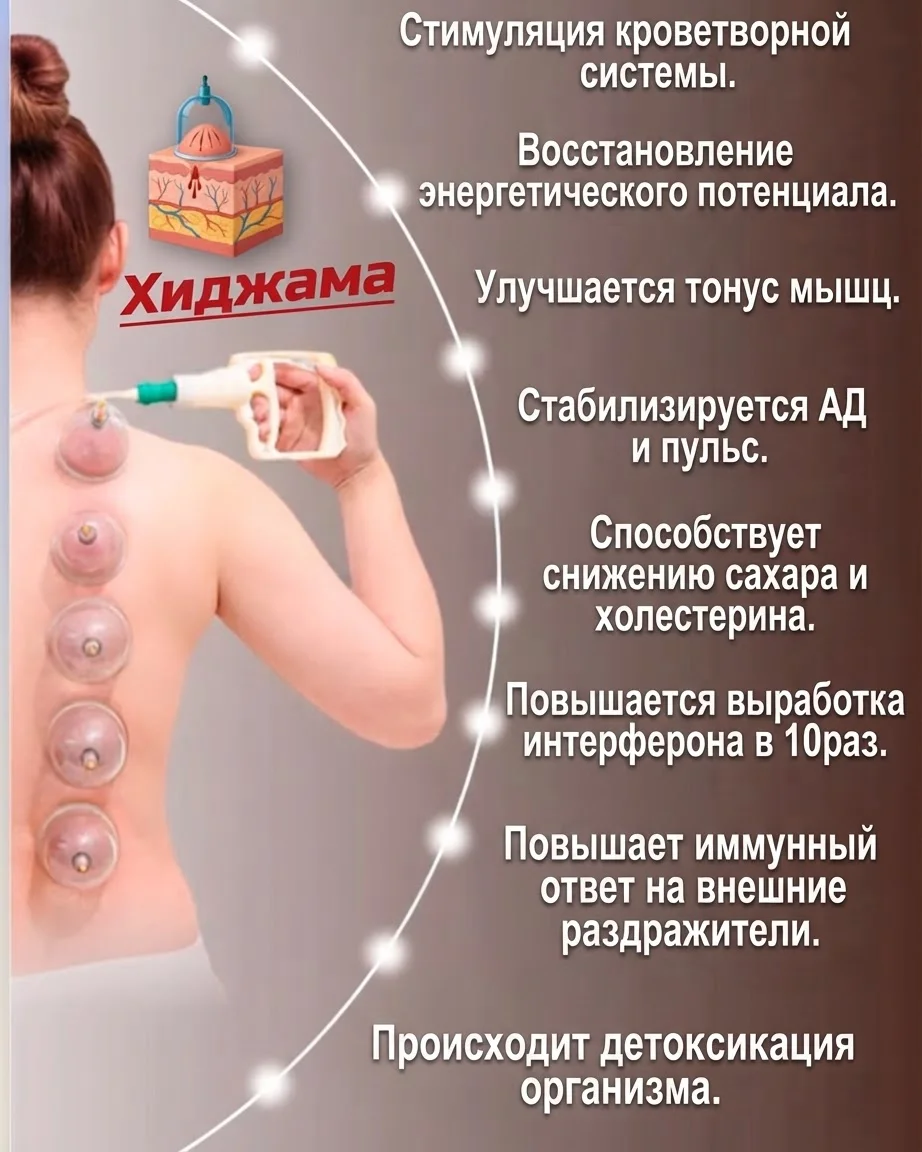 Хиджама — капиллярное кровопускание при застое крови — от 10000тг, 60 мин